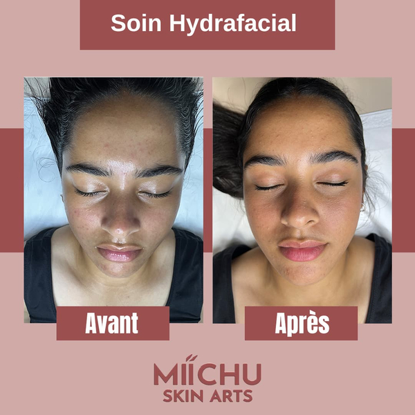 Photo de couverture de Miichu Skin Art | HYDRAFACIAL EPILATION LASER & AMINCISSEMENT à TANGER
